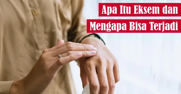 kulit sehat, perawatan alami