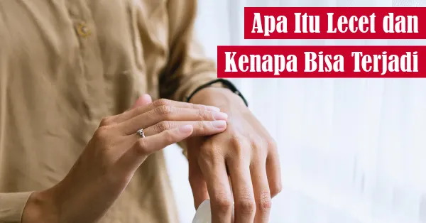 kulit, perawatan